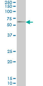 GGT1 monoclonal antibody (M01), clone 1F9