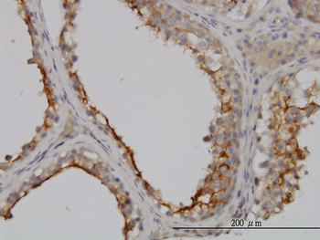 GGT1 monoclonal antibody (M01), clone 1F9