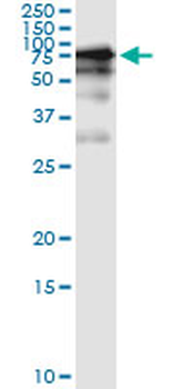 GGT1 monoclonal antibody (M01), clone 1F9