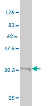 GGT1 monoclonal antibody (M01), clone 1F9
