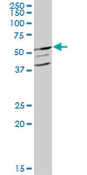 GCK MaxPab mouse polyclonal antibody (B01)