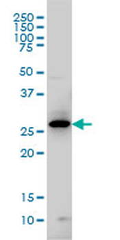 GCH1 monoclonal antibody (M01), clone 4A12