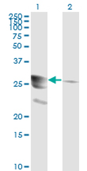 GCH1 monoclonal antibody (M01), clone 4A12