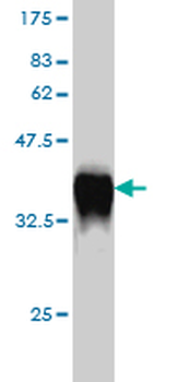 GCH1 monoclonal antibody (M01), clone 4A12