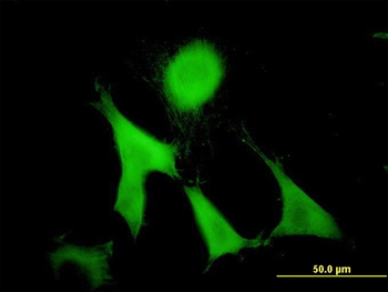 GAS2 monoclonal antibody (M01), clone 4E11