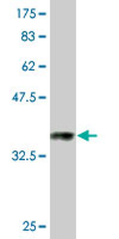 GAPDH monoclonal antibody (M03), clone 1G5