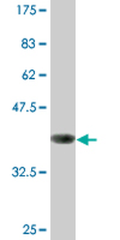 GAPDH monoclonal antibody (M01A), clone 3C2