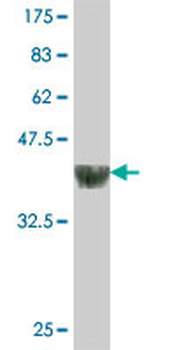 GABPB2 polyclonal antibody (A01)