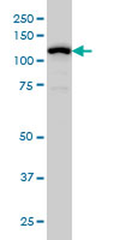 GABBR1 monoclonal antibody (M01), clone 2D7