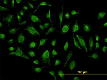 GABBR1 monoclonal antibody (M01), clone 2D7
