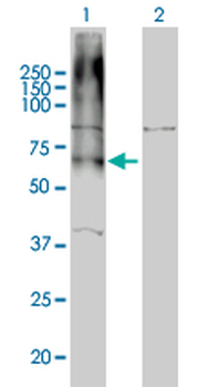 GABBR1 monoclonal antibody (M01), clone 2D7