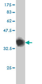 GABBR1 monoclonal antibody (M01), clone 2D7