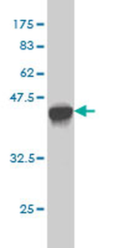 GAA monoclonal antibody (M01), clone 3C6