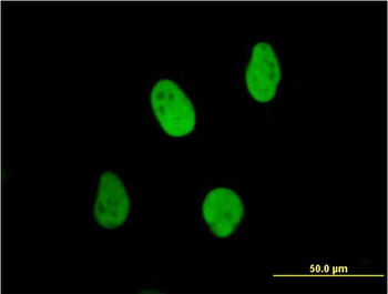 XRCC6 monoclonal antibody (M01), clone 4C2-1A6