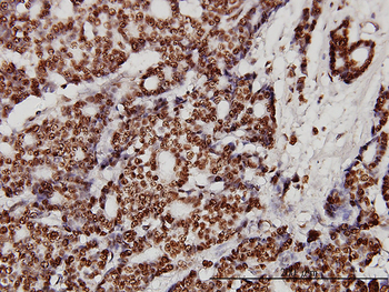 XRCC6 monoclonal antibody (M01), clone 4C2-1A6