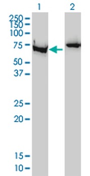 XRCC6 monoclonal antibody (M01), clone 4C2-1A6