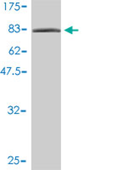 XRCC6 monoclonal antibody (M01), clone 4C2-1A6