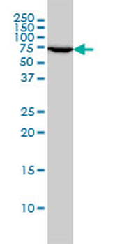 XRCC6 monoclonal antibody (M01), clone 4C2-1A6
