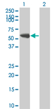 FYN monoclonal antibody (M01), clone 3G11-F9