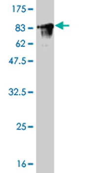 FYN monoclonal antibody (M01), clone 3G11-F9