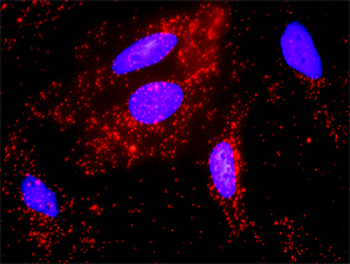 FYN purified MaxPab rabbit polyclonal antibody (D01P)