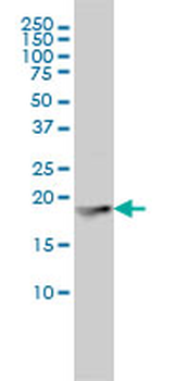 FTL monoclonal antibody (M16), clone X1