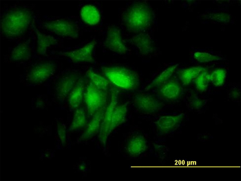 FTL monoclonal antibody (M16), clone X1