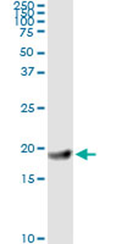 FTL monoclonal antibody (M16), clone X1