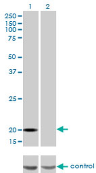 FTL monoclonal antibody (M16), clone X1