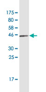 FTL monoclonal antibody (M16), clone X1