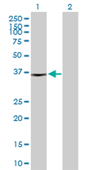 FRZB purified MaxPab rabbit polyclonal antibody (D01P)