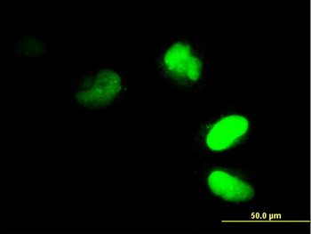 FRG1 monoclonal antibody (M01), clone 4A5