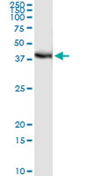 FRG1 monoclonal antibody (M01), clone 4A5