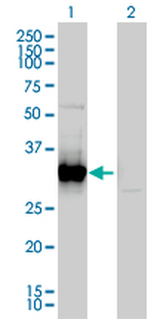 FRG1 monoclonal antibody (M01), clone 4A5