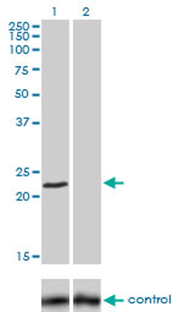 FXN monoclonal antibody (M03), clone 3G9