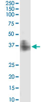 FPR2 monoclonal antibody (M04), clone 2H7