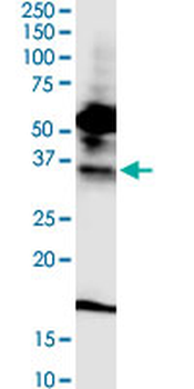 FPR2 monoclonal antibody (M03), clone 2G8