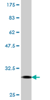 FPR2 monoclonal antibody (M03), clone 2G8