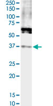 FPR2 monoclonal antibody (M02), clone 2D8