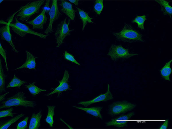FPR2 monoclonal antibody (M02), clone 2D8