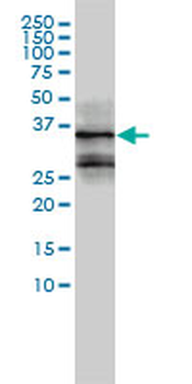 FOSL2 monoclonal antibody (M01), clone 2B4-1C2