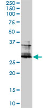 FOSL2 monoclonal antibody (M01), clone 2B4-1C2