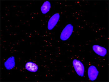 FOS monoclonal antibody (M14), clone 2D11