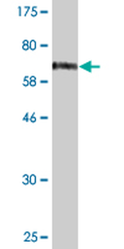 FOS monoclonal antibody (M14), clone 2D11