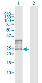 FOLR1 purified MaxPab rabbit polyclonal antibody (D01P)