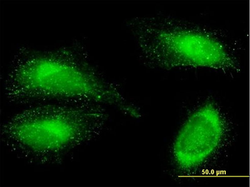 FN1 purified MaxPab mouse polyclonal antibody (B01P)