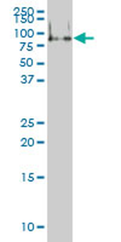 FMR1 monoclonal antibody (M01), clone 2D4