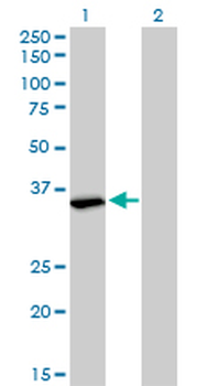 FMR1 monoclonal antibody (M01), clone 2D4