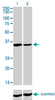 FMR1 monoclonal antibody (M01), clone 2D4