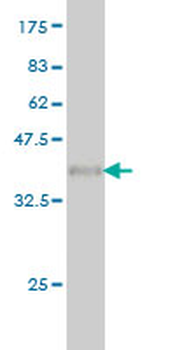 FMR1 monoclonal antibody (M01), clone 2D4